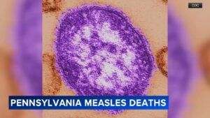Pennsylvania Reports First Measles Deaths in 35 Years